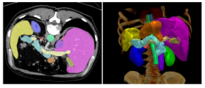 Example CT